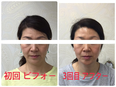 「美容外科に行かなくてもよくなりました＾＾」（池田市　５０代）