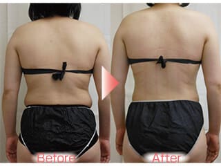 健康的に痩せれそう♪　（池田市３８才Ｈ様）