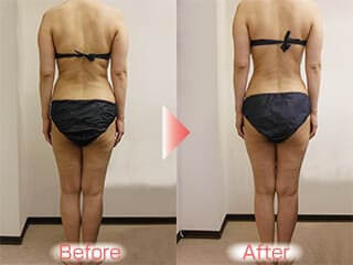 ４か月で８．６キロ痩せました！　（池田市５１才Ｔ様）