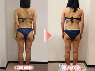 体のガチガチがとれました　（川西市４１才）