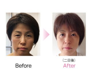 「お肌のハリがよみがえる（ハート）」　（川西市）