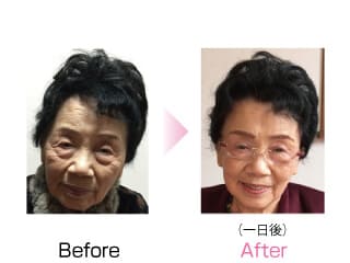「８６才が７０才に若返り！」
