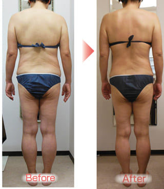 【お酒好きでもダイエット成功しました！（箕面市　６０代）】