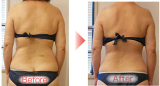 【親戚から痩せたねって言ってもらえるようになりました。（川西市　５０代）】