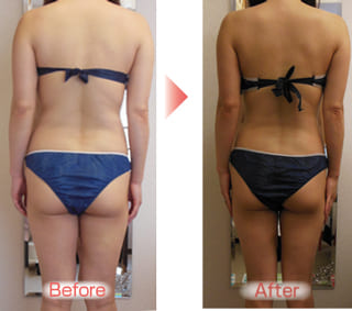 【３回で変わりました♬（池田市　４０代）】